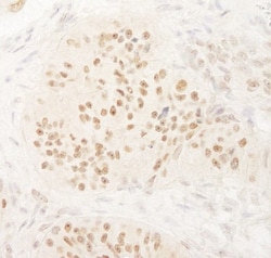 KIFC1 Antibody, Novus Biologicals 0.1mg; Unlabeled:Antibodies, Polyclonal